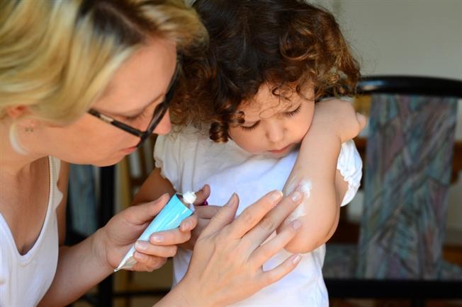 Parent applying ointment to cut