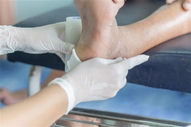 Diabetic foot wound Diabetic foot wound