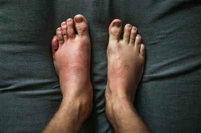 Download Blog How To Prevent Blood Clots When Flying Main Line Health Free Get Wallpaper Blog How To Prevent Blood Clots When Flying Main Line Health Desktop Wallpaper Free