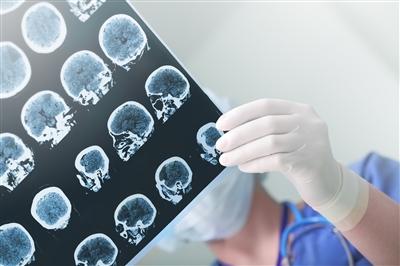Physician studying EEG of patient