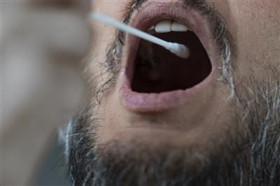 Close up of mans mouth getting a cheek swab DNA sample