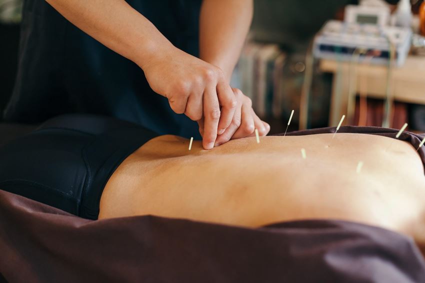 Person receiving acupuncture to relieve allergy symptoms