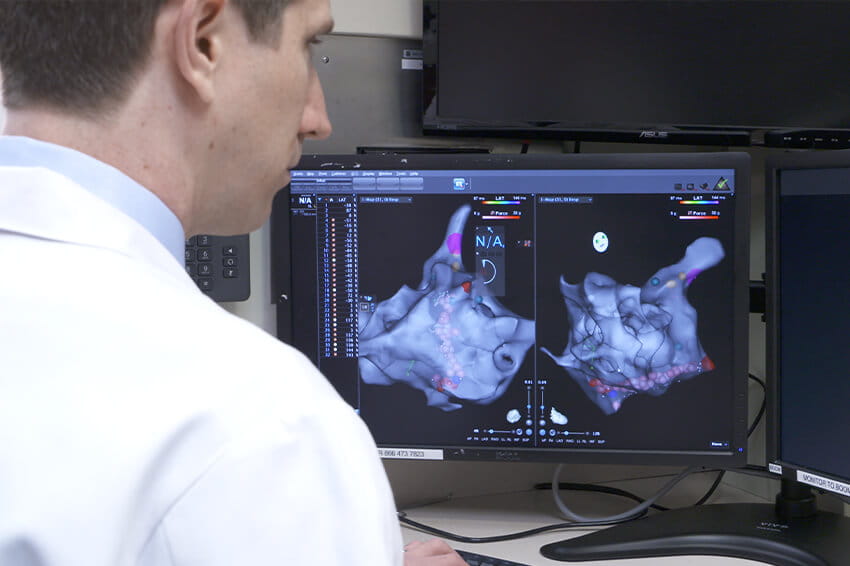Cerebral artery scan