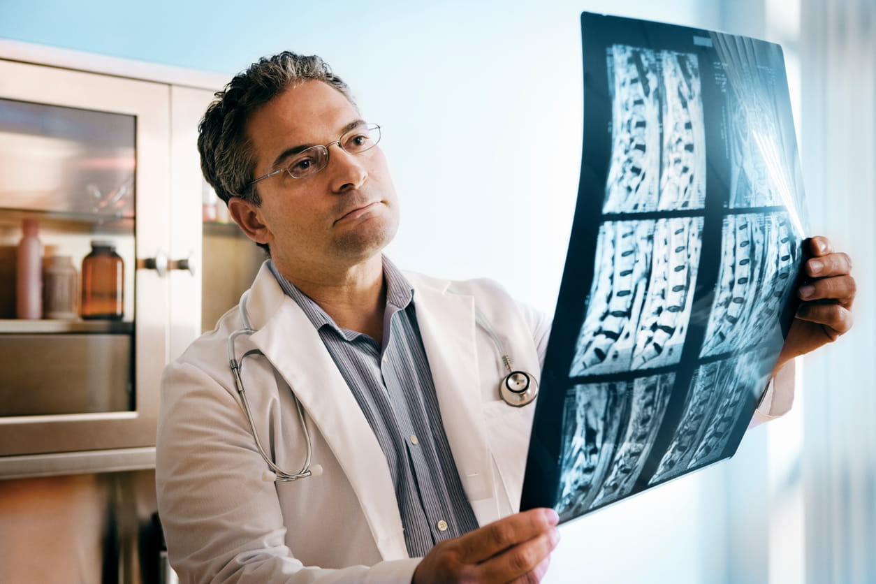Doctor looking at spine X-rays in a doctor's office.