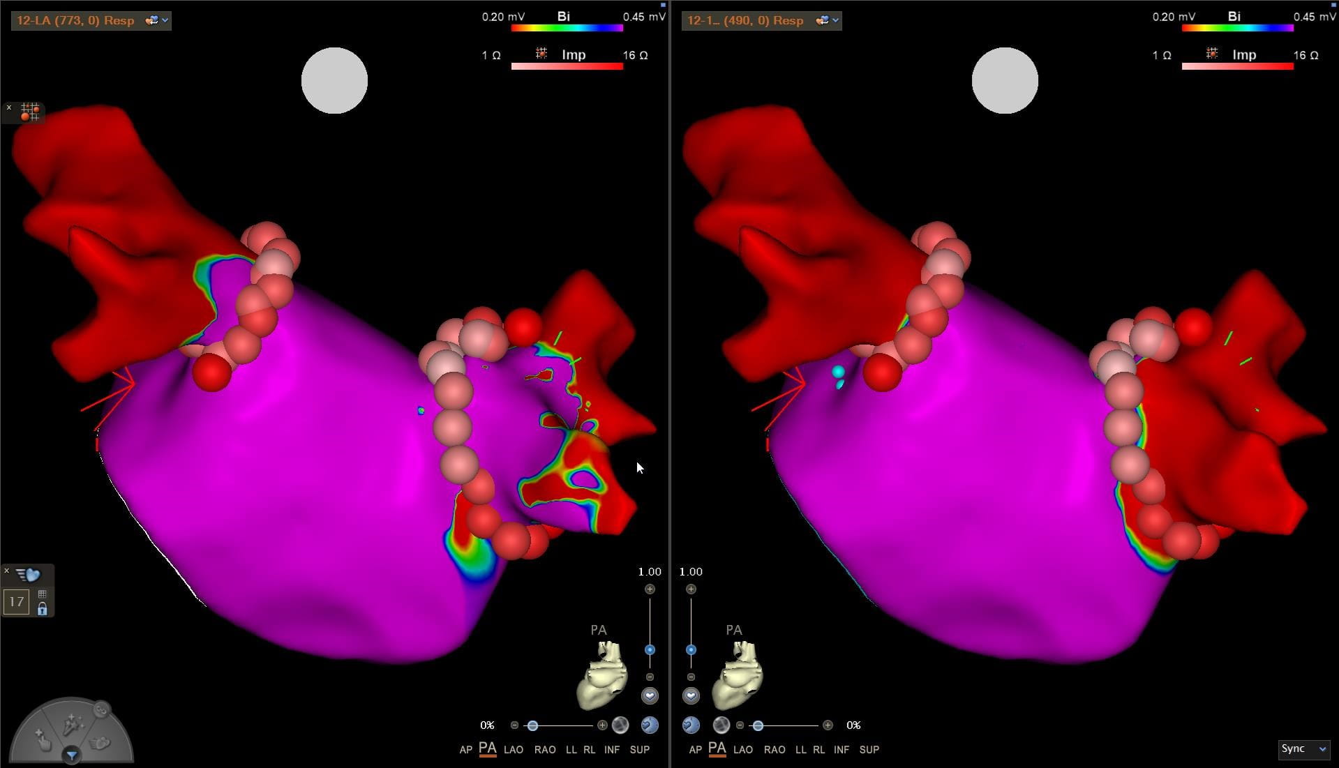 heart scan