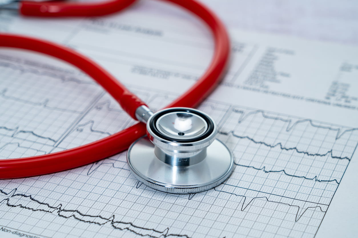 Stethoscope on electrocardiogram