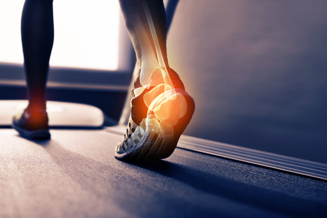 Person walking on treadmill, image layover of X-ray looking at ankle bone Person walking on treadmill, image layover of X-ray looking at ankle bone