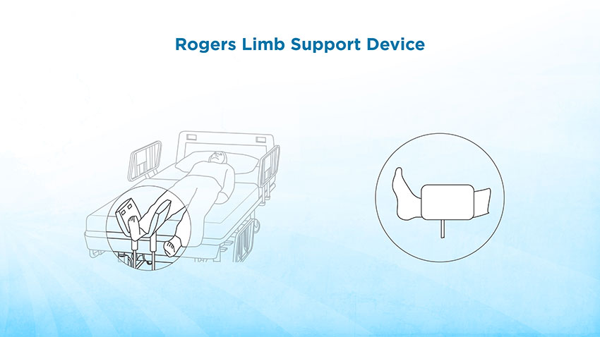 The Rogers Limb Support Device