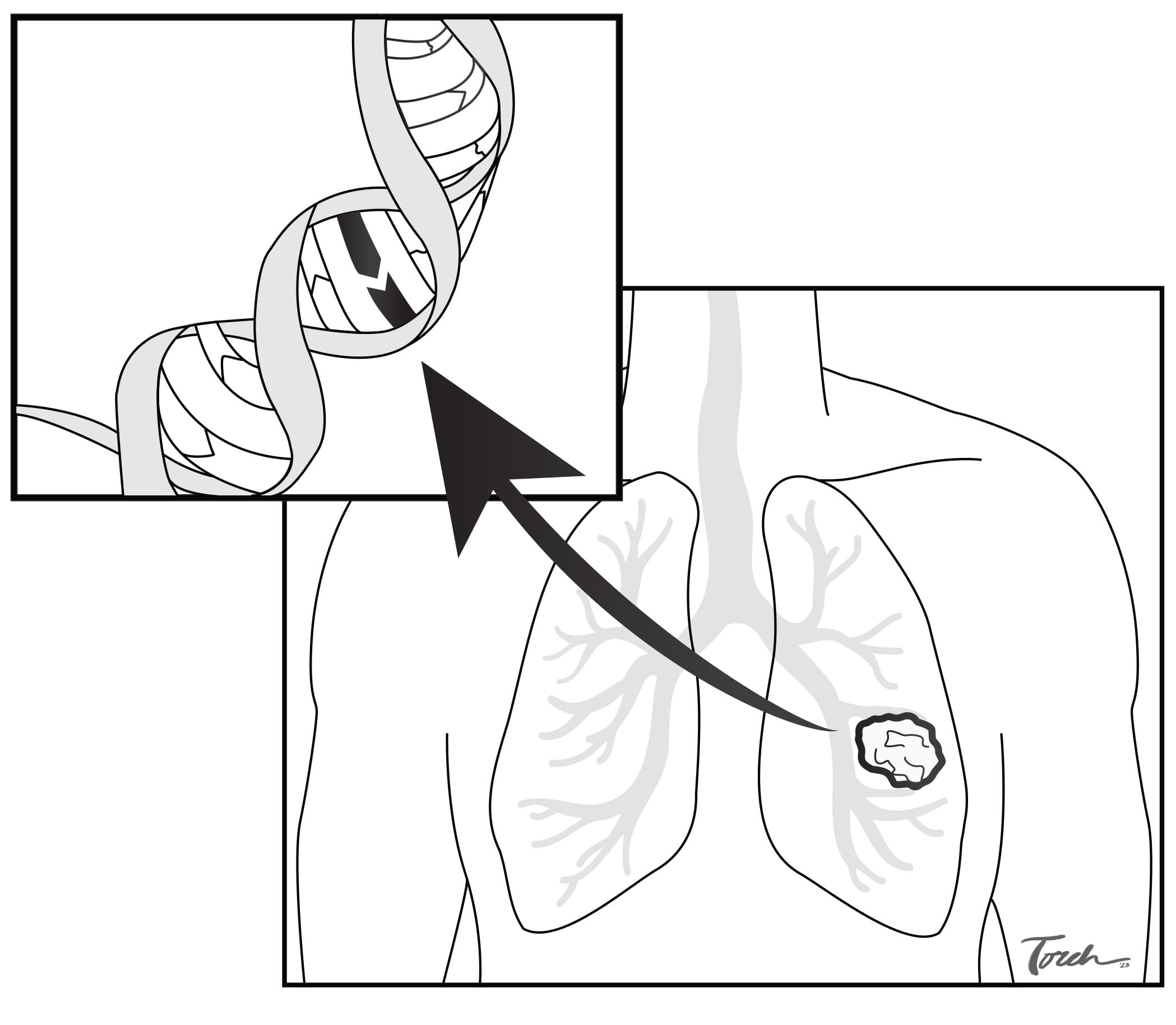DNA biopsy illustration