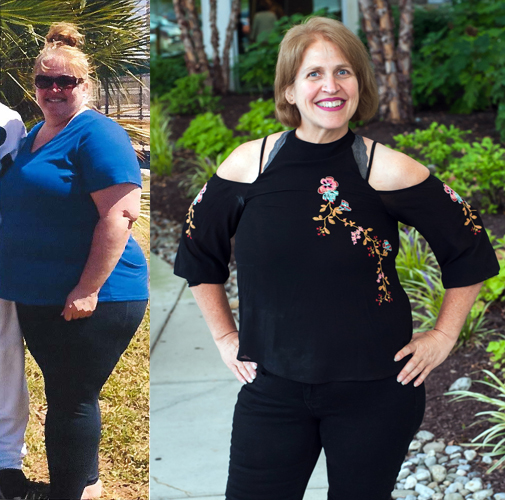 Weight loss surgery philadelphia Weight loss surgery philadelphia